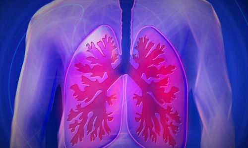 Why it's hard to know the impact of cannabis on lungs