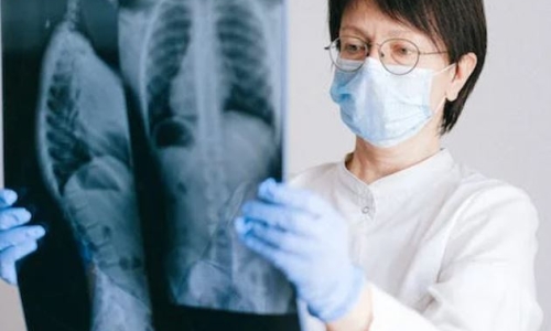 Does Cannabis smoke really cause more lung damage than tobacco smoke? Flaws in a viral study