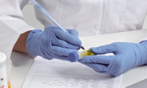 Does CBD show up on drug tests?